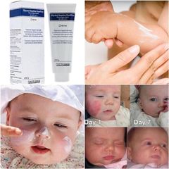 Kem dưỡng ẩm, giảm nẻ, chàm da Glycerol 250g nội địa Pháp