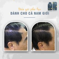 Dầu Gội Phủ Bạc Hàn Quốc Iglow Hair Tốt Cho Tóc