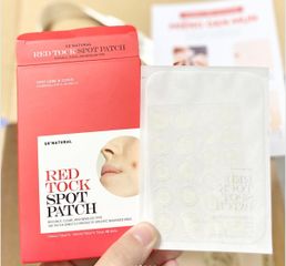 Miếng Dán Mụn So'Natural Red Tock Spot Patch
