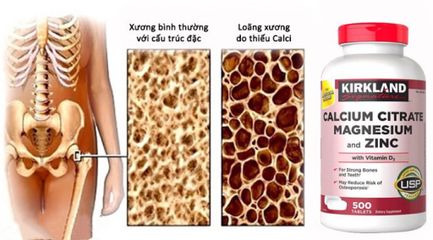 Viên uống bổ sung Canxi D3 Kẽm Magnesium 500 viên - Hỗ trợ xương khớp, tăng cường sức khỏe từ KIRKLAND SIGNATURE Mỹ