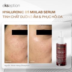 Serum phục hồi và làm dịu da Ekseption hyaluronic B5 Mixlab 75ml