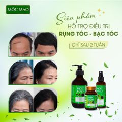 Tinh Dầu Xịt Tóc Mộc Mao Hỗ Trợ  Mọc Tóc, Ngăn Rụng Tóc