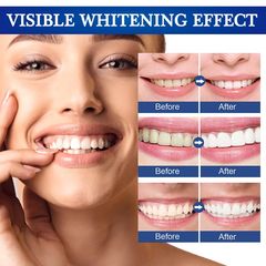 Gel bôi làm trắng, sáng răng, giảm ố vàng, cao răng, hôi miệng – 1223