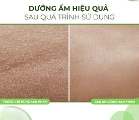 Xà Phòng Dưỡng Ẩm Mềm Mịn Da Fixderma Moisturizing Bar 100g