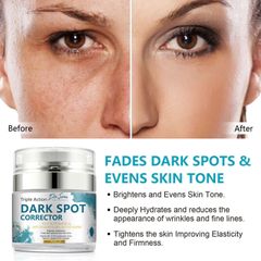 Kem dưỡng trắng da mờ nám và ngăn ngừa lão hoá Dr.Sera Dark Spot Corrector - 50ml