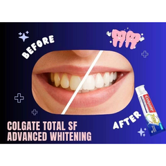 Kem Đánh Răng Colgate Total Advanced Whitening 181g Mỹ, Kem Đánh Răng Colgate Mỹ