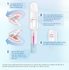 Bộ test xét nghiệm HIV bằng dịch miệng - OraQuick HIV không cần lấy máu