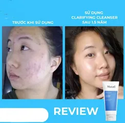 [Hàng C.Ty] Gel rửa mặt cho da mụn Murad Acne Control Clarifying Cleanser 200ml