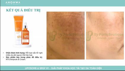 Tinh Chất Dưỡng Trắng Mờ Thâm Nám Ahohwa Whitening Ampoule NTG 30ml - Serum Làm Sáng Da Hiệu Quả, Phù Hợp Mọi Loại Da