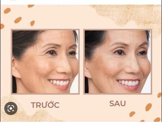 Hộp 30 ống Collagen biển thủy phân Marine (50.000mg) - Hỗ trợ tái tạo và duy trì độ đàn hồi của da