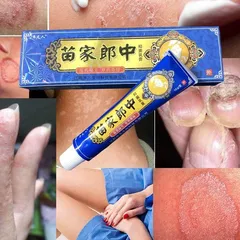 kem bôi da chống nấm ngứa, mề đay, hắc lào, nấm da đầu, khô da, nứt nẻ...(xanh dương)