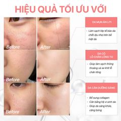 Toner Tẩy Tế Bào Chết GUO 5% AHA + 1% BHA - Se Khít Lỗ Chân Lông, Bổ Sung Lợi Khuẩn Prebiotic 120ml, Chăm Sóc Da Mịn Màng