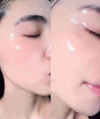 Mặt Nạ Nhau Thai Tế Bào Gốc Rwine Beauty Nhật Bản - Dưỡng Ẩm, Nuôi Dưỡng Da Mềm Mại, Làm Sáng Da, Chống Lão Hóa