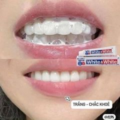 Kem Đánh Răng White & White Lion 150gr - Bảo Vệ Răng Miệng, Chăm Sóc Sức Khỏe Răng Miệng Cho Cả Gia Đình, Hương Bạc Hà Thơm Mát