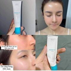 Kem Dưỡng Da Trẻ Hóa, Ngừa Mụn Obagi 360 Retinol Cream 28G