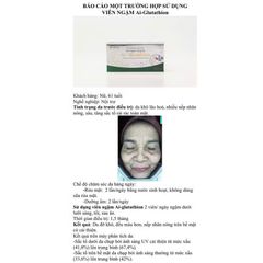 Viên Ngậm Trắng Da AI Glutathion Cosvia Làm Sáng Da Bật Tông, Ngăn Ngừa Nám, Tàn Nhang, Lão Hoá - 30 Viên