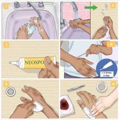Kem Mỡ Trị Sẹo Neosporin + Giảm Đau 14.2g - Sản Phẩm Chăm Sóc Da, Giảm Sẹo Và Ngăn Ngừa Nhiễm Trùng Hàng Ngày