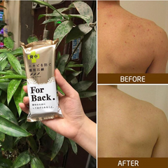 Xà Phòng Hỗ Trợ Giảm Mụn Lưng Pelican For Back Medicated Soap 135g