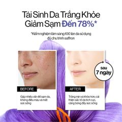 Tinh Chất Đậm Đặc Gilaa Saffron 5ml, Serum Làm Sáng Da, Khôi Phục Độ Đều Màu, Chứa Retinol & Vitamin C, Mỹ Phẩm Hàn Quốc