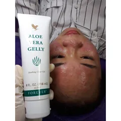 Gel Dưỡng Da Forever Aloe Vera Gelly 118ml - Giảm Mụn, Sẹo, Chăm Sóc Da Nhạy Cảm, Phục Hồi Da Hư Tổn