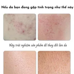 Mặt Nạ Dưỡng Da Chiết Xuất Thiên Nhiên 25g - Cấp Ẩm, Dưỡng Trắng, Giảm Mụn, Mờ Thâm Căng Bóng, Thư Giãn Da Chất Lượng Cao