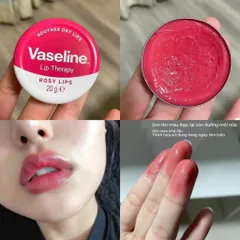 Son Dưỡng Môi Dạng Sáp Vaseline Lip Therapy Hộp Thiếc 20g - Đem lại Môi Mềm Mịn và Hồng Hào, Giải Pháp Chăm Sóc Môi Hoàn Hảo