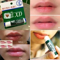 Set 2 son dưỡng ẩm Rohto Mentholatum Medicated