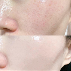 Serum Trắng Da Cấp Ẩm Trẻ Hóa High Class Moist Essence 60ml - Chăm Sóc Da, Giảm Nếp Nhăn, Làm Sáng Da Tự Nhiên
