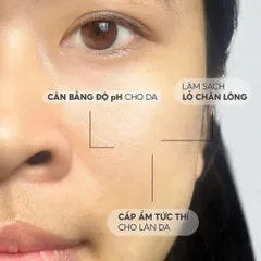 Bộ Sản Phẩm Làm Đẹp Lalamos Mini Size: Nước Tẩy Trang, Sữa Rửa Mặt & Toner Kim Ngân Hoa 50ml - Dưỡng Ẩm & Ngăn Ngừa Mụn