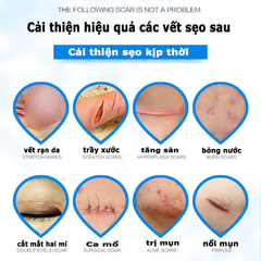 Kem Xóa Sẹo Dermatix Ultra 20g - Giảm Mờ Sẹo Phẫu Thuật, Dưỡng Ẩm, Thẩm Thấu Nhanh, An Toàn Cho Người Lớn và Trẻ Em Từ 6 Tháng
