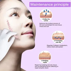 Kem Làm Mờ Sẹo OUHOE - Giảm Thâm, Xóa Sẹo Cũ, Côn Trùng Cắn, Sẹo Lồi - Chăm Sóc Da Tất Cả Các Loại Da, 50g
