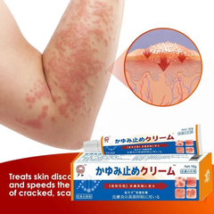 Kem Bôi Nấm Nhật Bản - Chống Viêm Da, Hắc Lào, Tổ Đĩa, Chàm, Nấm, Dị Ứng - Chăm Sóc Cơ Thể Hiệu Quả