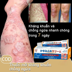 Kem Bôi Nấm Nhật Bản - Chống Viêm Da, Hắc Lào, Tổ Đĩa, Chàm, Nấm, Dị Ứng - Chăm Sóc Cơ Thể Hiệu Quả