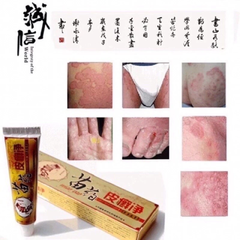 Kem Bôi Da Liễu CHA-REN - Giảm Ngứa, Hắc Lào, Vảy Nến, Lang Ben - Hàng Xuất Khẩu Châu Âu Chất Lượng Cao