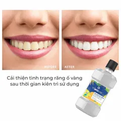 Dầu Dừa Súc Miệng Vietcoco Hương Bạc Hà 225ml - Giúp Diệt Khuẩn, Ngăn Ngừa Sâu Răng, Tươi Mát Hơi Thở, Không Chứa Cồn