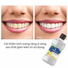 Dầu Dừa Súc Miệng Vietcoco Hương Bạc Hà 225ml - Không Cồn, Diệt Khuẩn, Hỗ Trợ Sức Khỏe Răng Miệng