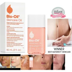 (Hàng úc)  Tinh Dầu Bio Oil Mờ Sẹo Và Giảm Rạn Da của Úc