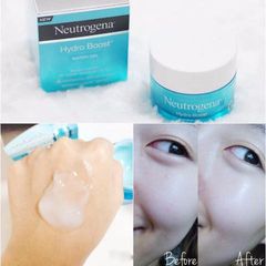 Kem Dưỡng Ẩm Neutrogena