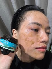 Mặt Nạ Mụn Bạch Hoa Xà DVi Nature - Gel Trị Mụn Tự Nhiên Giúp Giảm Viêm, Đẹp Da Và Ngăn Ngừa Mụn Tái Phát