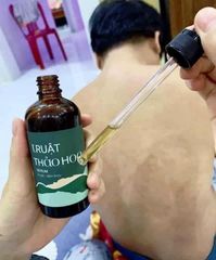 Truật Thảo Hoa D'Vi Nature - Sản Phẩm Chăm Sóc Da Hỗ Trợ Giảm Mụn Lưng & Mụn Ngực Từ Thiên Nhiên, An Toàn Và Hiệu Quả