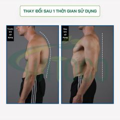 Đai Lưng Chống Gù Y Tế Hatoco Cao Cấp - Cải Thiện Tư Thế, Giảm Đau Lưng, Thoáng Khí, Hỗ Trợ Định Hình Cột Sống Cho Nam Nữ