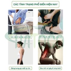 Đai Chống Gù Lưng Y Tế Hatoco - Nẹp Cứng Hỗ Trợ Định Hình Cột Sống, Giải Pháp Cải Thiện Tư Thế Hiệu Quả, Thoải Mãi Khi Sử Dụng