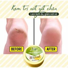 Kem Nứt Gót Chân Chiết Xuất Chuối & Bơ Hạt Mỡ - Dưỡng Da Mềm Mại & Chống Nứt Gót Chân Thái Lan