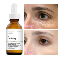 Serum The Ordinary 100% Organic Cold-Pressed Rose Hip Seed Oil 30ml 240839