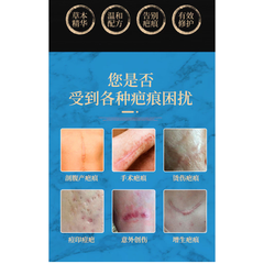 Kem Xóa Sẹo 20g Dermatix Ultra - Gel Mờ Hiệu Quả Vết Sẹo Lâu Năm, Phẫu Thuật, Bảo Vệ Da Uv, Dưỡng Ẩm Silicon Polymer