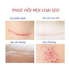 Kem Xóa Sẹo 20g Dermatix Ultra - Gel Mờ Hiệu Quả Vết Sẹo Lâu Năm, Phẫu Thuật, Bảo Vệ Da Uv, Dưỡng Ẩm Silicon Polymer