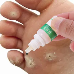 Kem Tẩy Mụn Cóc 10g - Gel Tẩy Nốt Ruồi Hiệu Quả 7 Ngày, Làm Sạch Da Mịn Màng, Giảm Sẹo Sẫm Màu, Dưỡng Ẩm Chất Lượng