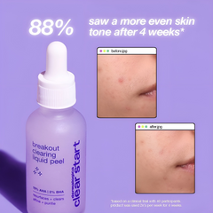 Serum Tẩy Da Chết Dermalogica Clear Start 30ml - Giải Pháp Cho Da Mụn, Làm Sáng Và Đều Màu Da, Giảm Thâm và Lỗ Chân Lông