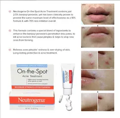 Kem Giảm Mụn Neutrogena On The Spot Acne Treatment 21G - Giúp Giảm Mụn Viêm Đỏ Nhanh Chóng, Phù Hợp Cho Da Nhạy Cảm