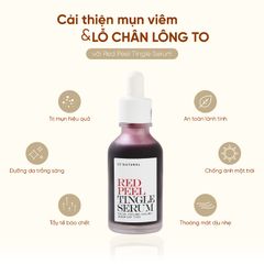 Tinh Chất Peel Tái Tạo Da So Natural Red Peel Tingle Serum 35ml - Hỗ Trợ Làm Sáng Da, Giảm Mụn Đầu Đen, Mờ Thâm